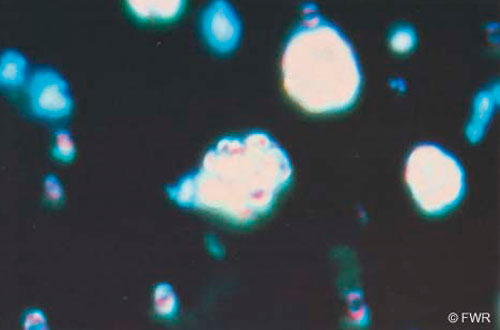 Fluorescencia natural de los hematies